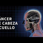 La otra cara del cáncer de cabeza y cuello: el desafío nutricional durante el tratamiento